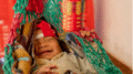سوتغذی